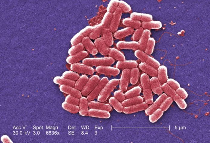 E_Coli_-794x540